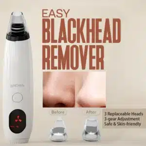 Gadgetoo Xiaomi Enchen Blackhead Remover Eb1001